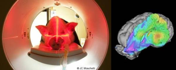 Analyse du métabolisme cérébral du glucose chez le porc par imagerie du 18Fluoro-Déoxy-Glucose en Tomographie d’Emission de Positron (TEP-scan).